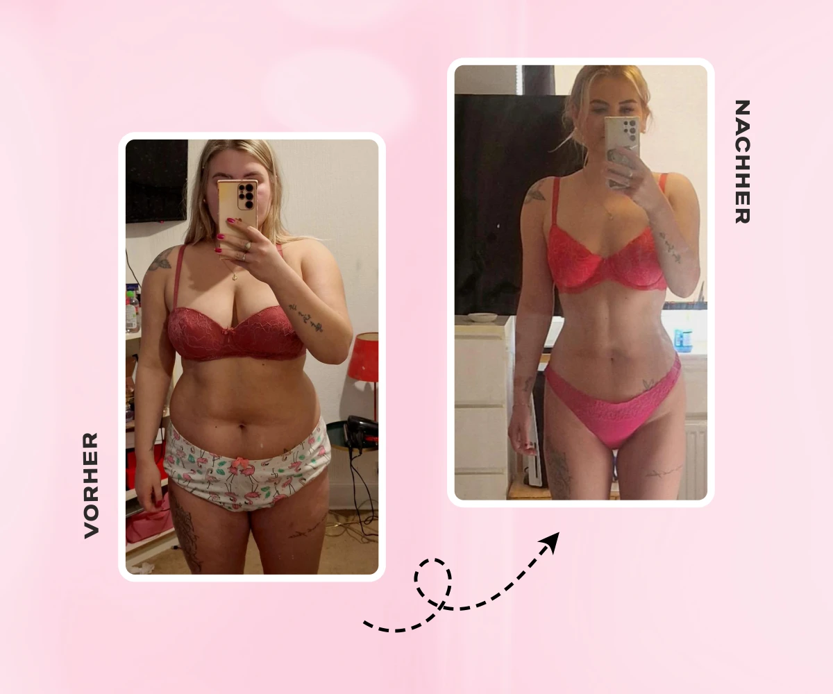 Magenverkleinerung Türkei